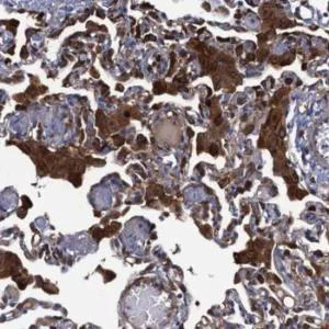 Immunohistochemistry (Formalin/PFA-fixed paraffin-embedded sections) - Anti-DNHD1 antibody (AB122574)