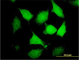 Immunocytochemistry/ Immunofluorescence - Anti-DNMBP antibody (AB88534), expandable thumbnail