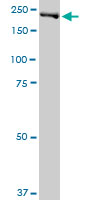Western blot - Anti-DNMBP antibody (AB88534), expandable thumbnail