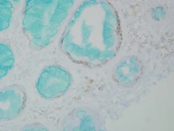 Immunohistochemistry (Formalin/PFA-fixed paraffin-embedded sections) - Anti-Dnmt1 antibody [60B1220.1] (AB13537)