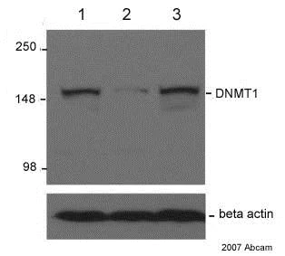 Western blot - Anti-Dnmt1 antibody [60B1220.1] (AB13537)