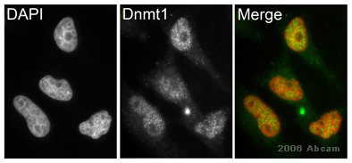 Immunocytochemistry/ Immunofluorescence - Anti-Dnmt1 antibody (ab19905), expandable thumbnail
