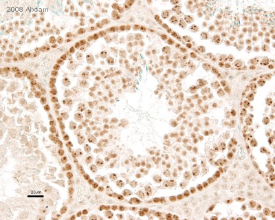 Immunohistochemistry (Formalin/PFA-fixed paraffin-embedded sections) - Anti-Dnmt1 antibody (AB19905), expandable thumbnail