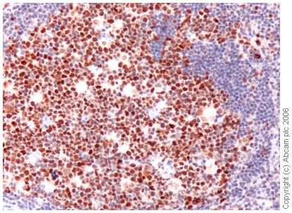 Immunohistochemistry (Formalin/PFA-fixed paraffin-embedded sections) - Anti-Dnmt1 antibody (AB19905)