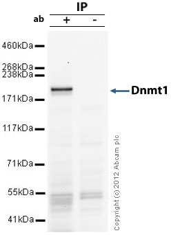 Immunoprecipitation - Anti-Dnmt1 antibody (AB19905), expandable thumbnail