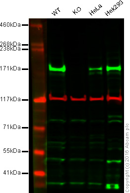 Western blot - Anti-Dnmt1 antibody (AB19905), expandable thumbnail