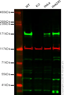 Western blot - Anti-Dnmt1 antibody (AB19905)