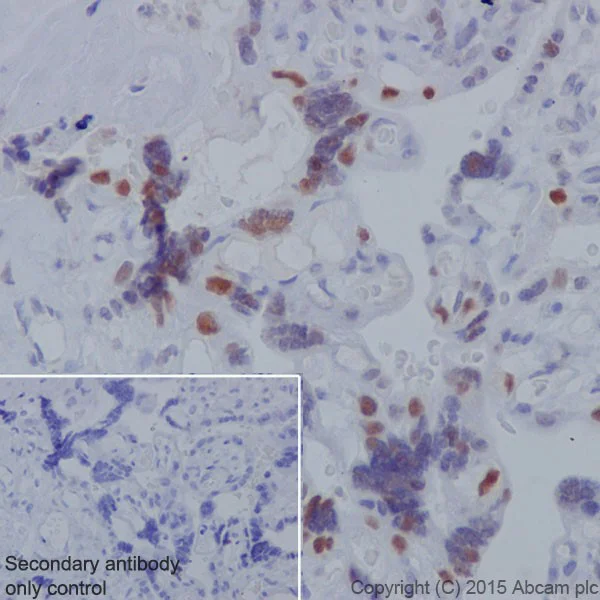 Immunohistochemistry (Formalin/PFA-fixed paraffin-embedded sections) - Anti-Dnmt1 antibody [EPR18453] (AB188453)