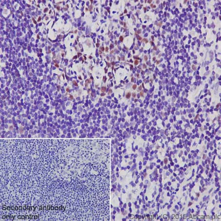 Immunohistochemistry (Formalin/PFA-fixed paraffin-embedded sections) - Anti-Dnmt1 antibody [EPR3521(2)] - BSA and Azide free (AB191382)