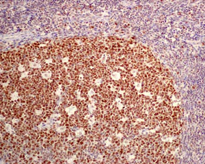Immunohistochemistry (Formalin/PFA-fixed paraffin-embedded sections) - Anti-Dnmt1 antibody [EPR3521(2)] - BSA and Azide free (AB191382)