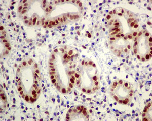 Immunohistochemistry (Formalin/PFA-fixed paraffin-embedded sections) - Anti-Dnmt1 antibody [EPR3521(2)] - BSA and Azide free (AB191382)