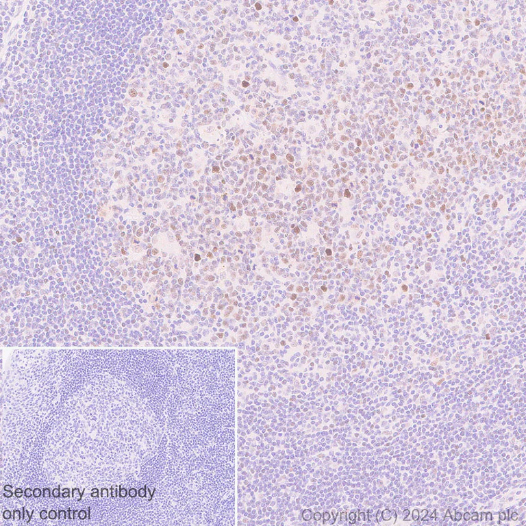 Immunohistochemistry (Formalin/PFA-fixed paraffin-embedded sections) - Anti-Dnmt1 antibody [EPR3522] - BSA and Azide free (AB207601)