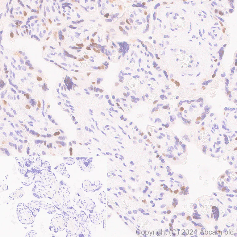 Immunohistochemistry (Formalin/PFA-fixed paraffin-embedded sections) - Anti-Dnmt1 antibody [EPR3522] - BSA and Azide free (AB207601)