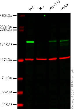 Western blot - Anti-Dnmt1 antibody [EPR3522] - BSA and Azide free (AB207601)