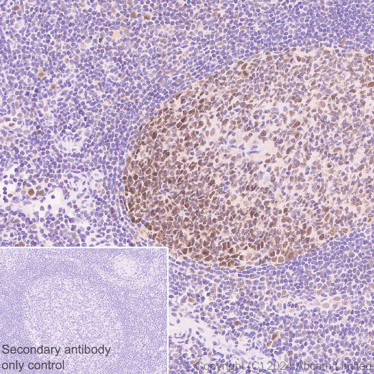 Immunohistochemistry (Formalin/PFA-fixed paraffin-embedded sections) - Anti-Dnmt1 antibody [RM1192] (AB317845)