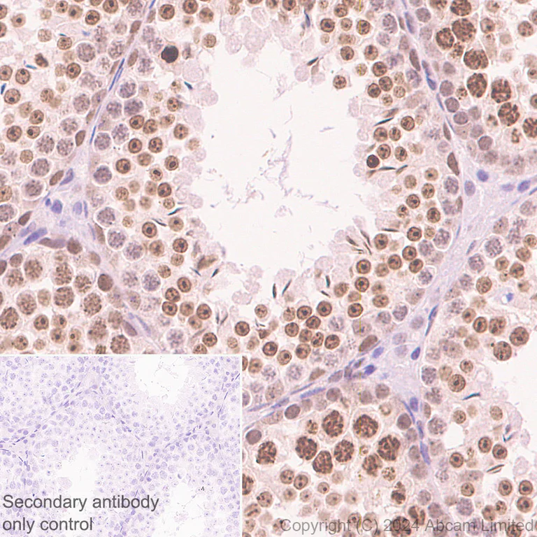 Immunohistochemistry (Formalin/PFA-fixed paraffin-embedded sections) - Anti-Dnmt1 antibody [RM1192] (AB317845)