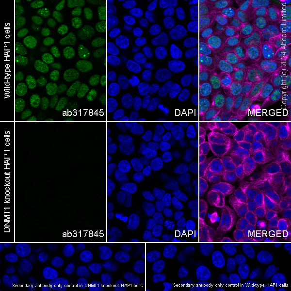 Immunocytochemistry/ Immunofluorescence - Anti-Dnmt1 antibody [RM1192] - BSA and Azide free (AB317846)