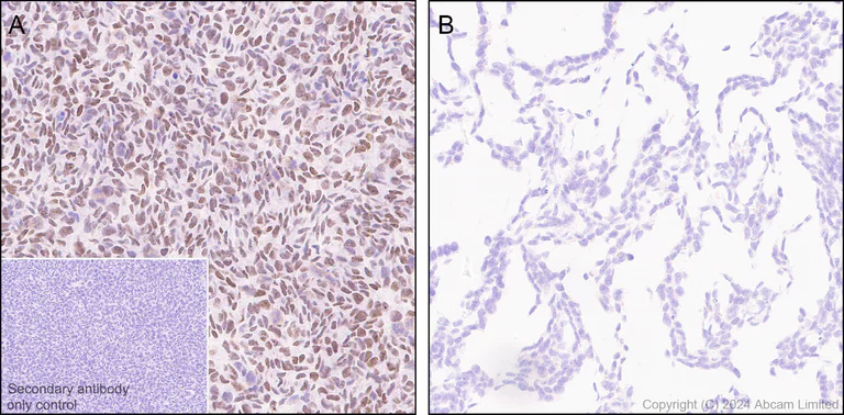 Immunohistochemistry (Formalin/PFA-fixed paraffin-embedded sections) - Anti-Dnmt1 antibody [RM1192] - BSA and Azide free (AB317846)