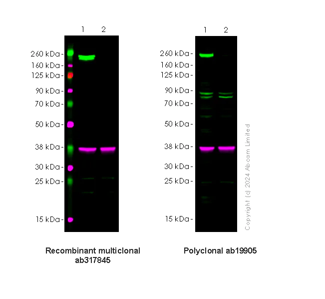 Western blot - Anti-Dnmt1 antibody [RM1192] - BSA and Azide free (AB317846)
