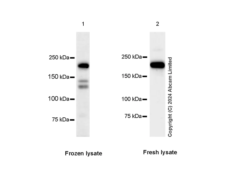 Western blot - Anti-Dnmt1 antibody [RM1192] - BSA and Azide free (AB317846)