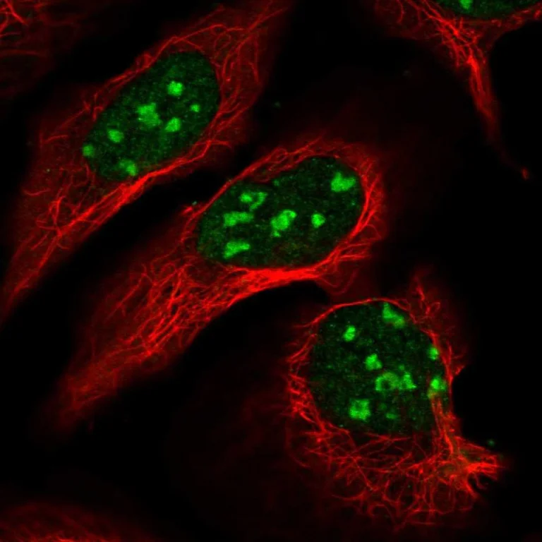 Immunocytochemistry/ Immunofluorescence - Anti-Dnmt2 antibody (AB244461)