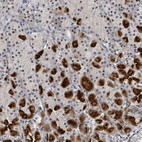 Immunohistochemistry (Formalin/PFA-fixed paraffin-embedded sections) - Anti-Dnmt2 antibody (AB244461)