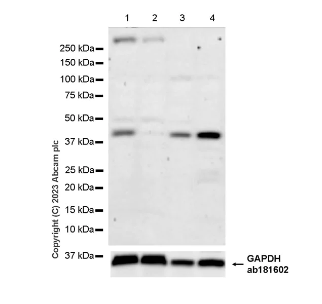 Western blot - Anti-Dnmt2 antibody [EPR24232-63] (AB308120)