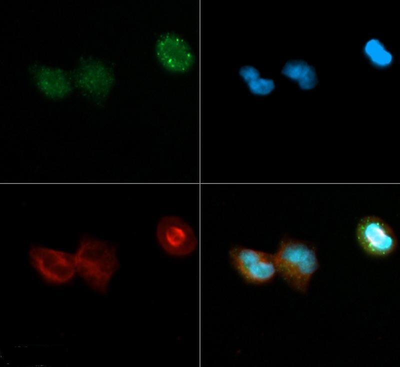 Immunocytochemistry - Anti-Dnmt3a antibody (AB16704)