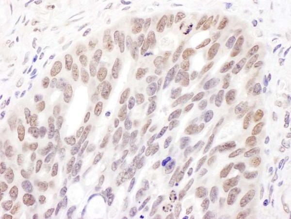 Immunohistochemistry (Formalin/PFA-fixed paraffin-embedded sections) - Anti-Dnmt3a antibody (AB226261), expandable thumbnail