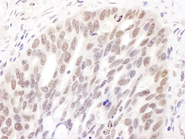 Immunohistochemistry (Formalin/PFA-fixed paraffin-embedded sections) - Anti-Dnmt3a antibody (AB226261)
