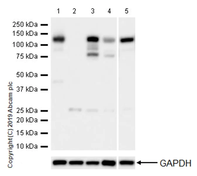 Western blot - Anti-Dnmt3a antibody [EPR18455-94] (AB227823)