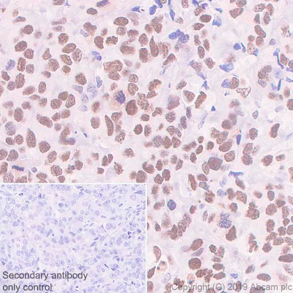 Immunohistochemistry (Formalin/PFA-fixed paraffin-embedded sections) - Anti-Dnmt3a antibody [EPR18455-94] - BSA and Azide free (AB254009)