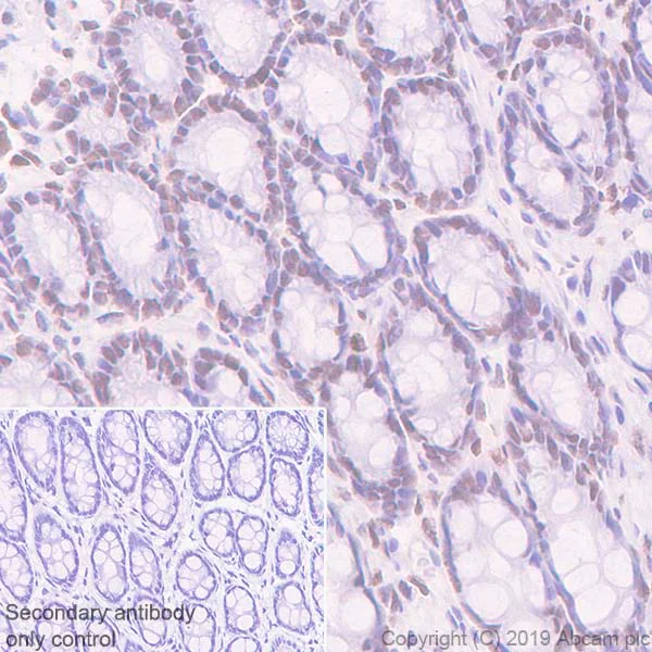 Immunohistochemistry (Formalin/PFA-fixed paraffin-embedded sections) - Anti-Dnmt3a antibody [EPR18455-94] - BSA and Azide free (AB254009)
