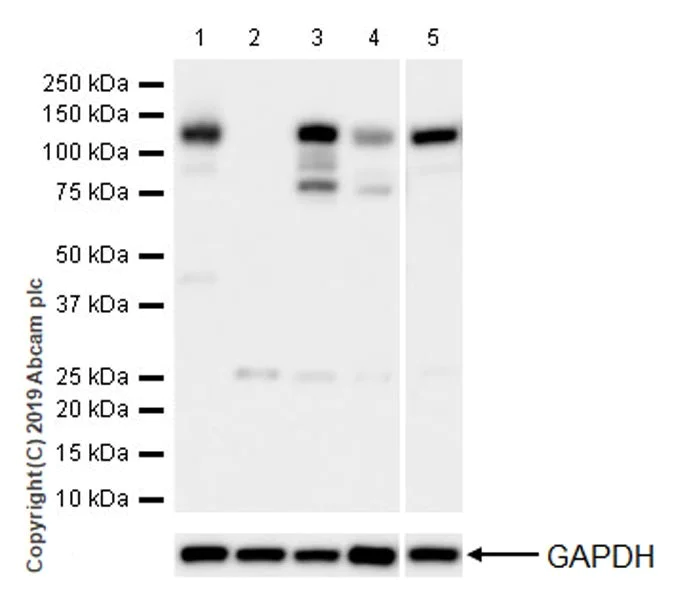 Western blot - Anti-Dnmt3a antibody [EPR18455-94] - BSA and Azide free (AB254009)