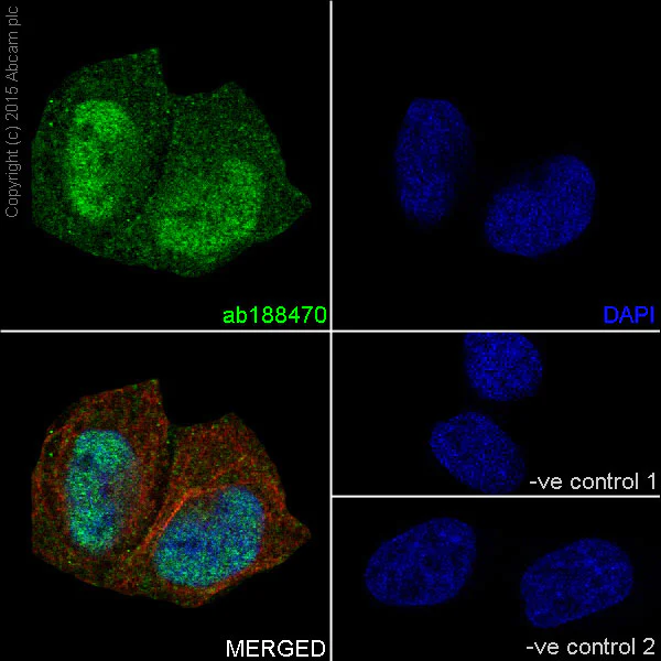 Immunocytochemistry/ Immunofluorescence - Anti-Dnmt3a antibody [EPR18455] (AB188470)