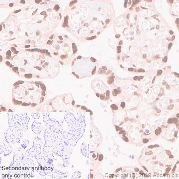 Immunohistochemistry (Formalin/PFA-fixed paraffin-embedded sections) - Anti-Dnmt3a antibody [EPR18455] (AB188470)