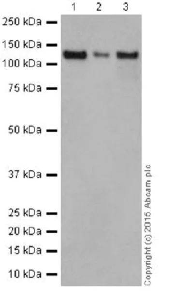 Western blot - Anti-Dnmt3a antibody [EPR18455] (AB188470)