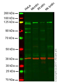 Western blot - Anti-Dnmt3a antibody [EPR18455] (AB188470)