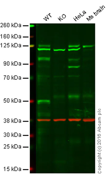 Western blot - Anti-Dnmt3a antibody [EPR18455] - BSA and Azide free (AB232391)