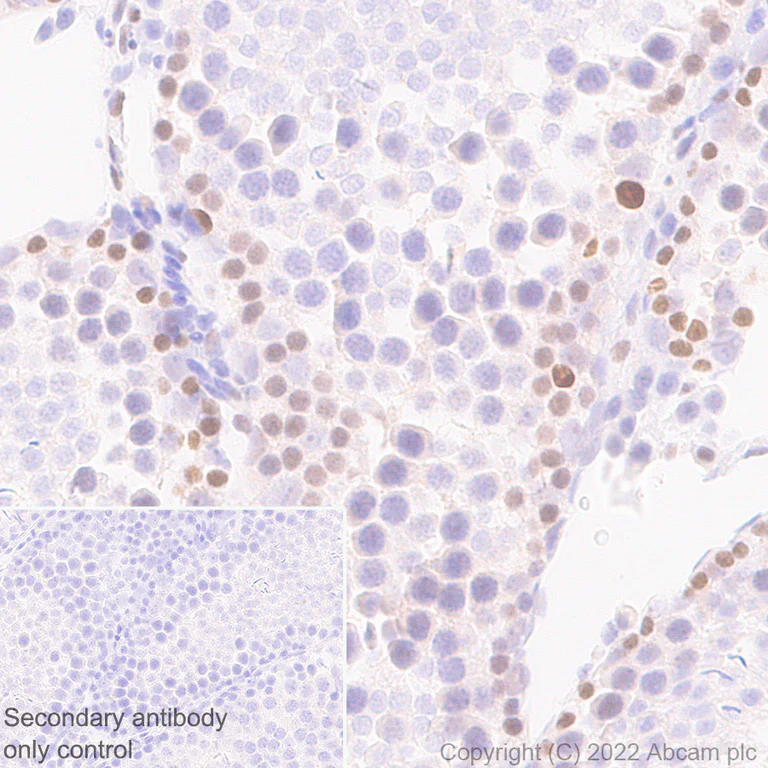 Immunohistochemistry (Formalin/PFA-fixed paraffin-embedded sections) - Anti-Dnmt3a antibody [EPR26805-273] (AB307503)