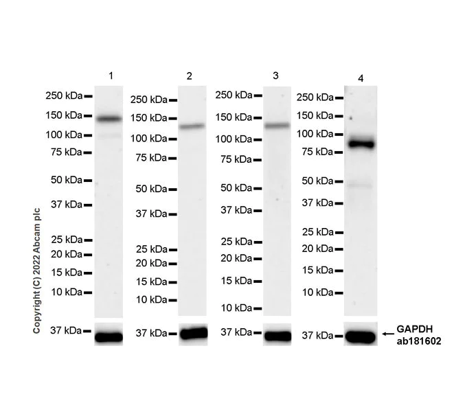 Western blot - Anti-Dnmt3a antibody [EPR26805-273] - BSA and Azide free (AB307504)