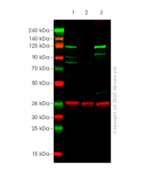 Western blot - Anti-Dnmt3a antibody [EPR26805-273] - BSA and Azide free (AB307504)