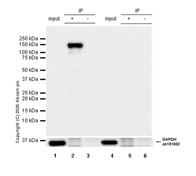 Immunoprecipitation - Anti-Dnmt3a antibody [EPR29184-89] (AB323708)