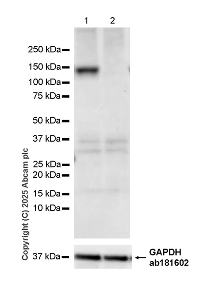 Western blot - Anti-Dnmt3a antibody [EPR29184-89] (AB323708)
