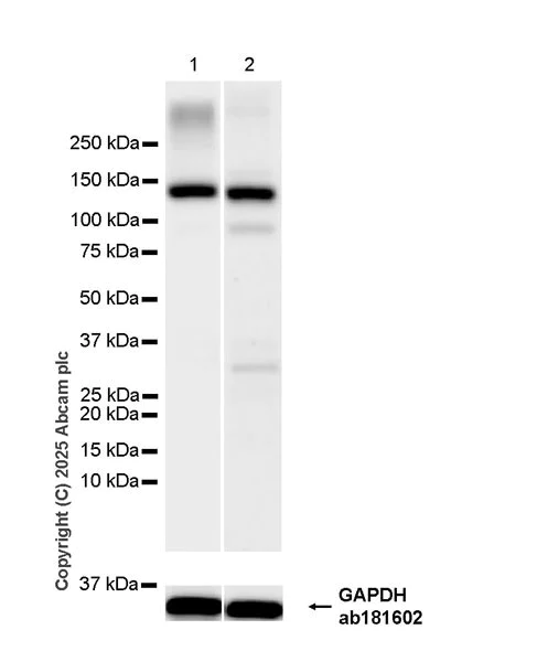 Western blot - Anti-Dnmt3a antibody [EPR29184-89] (AB323708)