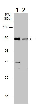 Western blot - Anti-Dnmt3a antibody - N-terminal (AB227725)
