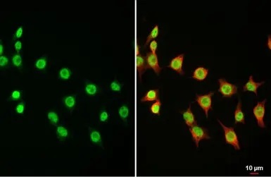 Immunocytochemistry/ Immunofluorescence - Anti-Dnmt3a antibody - N-terminal (AB228691)