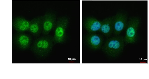 Immunocytochemistry/ Immunofluorescence - Anti-Dnmt3a antibody - N-terminal (AB228691), expandable thumbnail