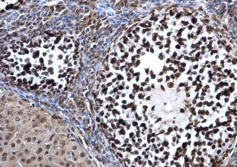 Immunohistochemistry (Formalin/PFA-fixed paraffin-embedded sections) - Anti-Dnmt3a antibody - N-terminal (AB228691), expandable thumbnail