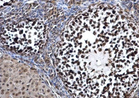 Immunohistochemistry (Formalin/PFA-fixed paraffin-embedded sections) - Anti-Dnmt3a antibody - N-terminal (AB228691)